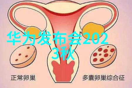 脉冲除尘器的工作原理与应用实践